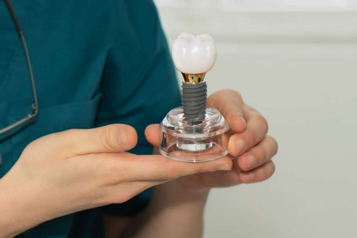 dental implants in Sulphur Springs