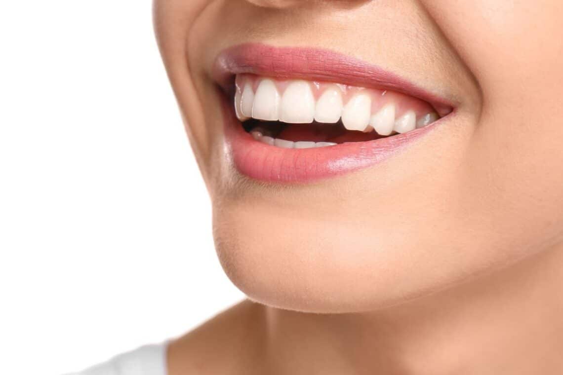 teeth-whiten-cosmetic-dentist-sulphur-springs-tx