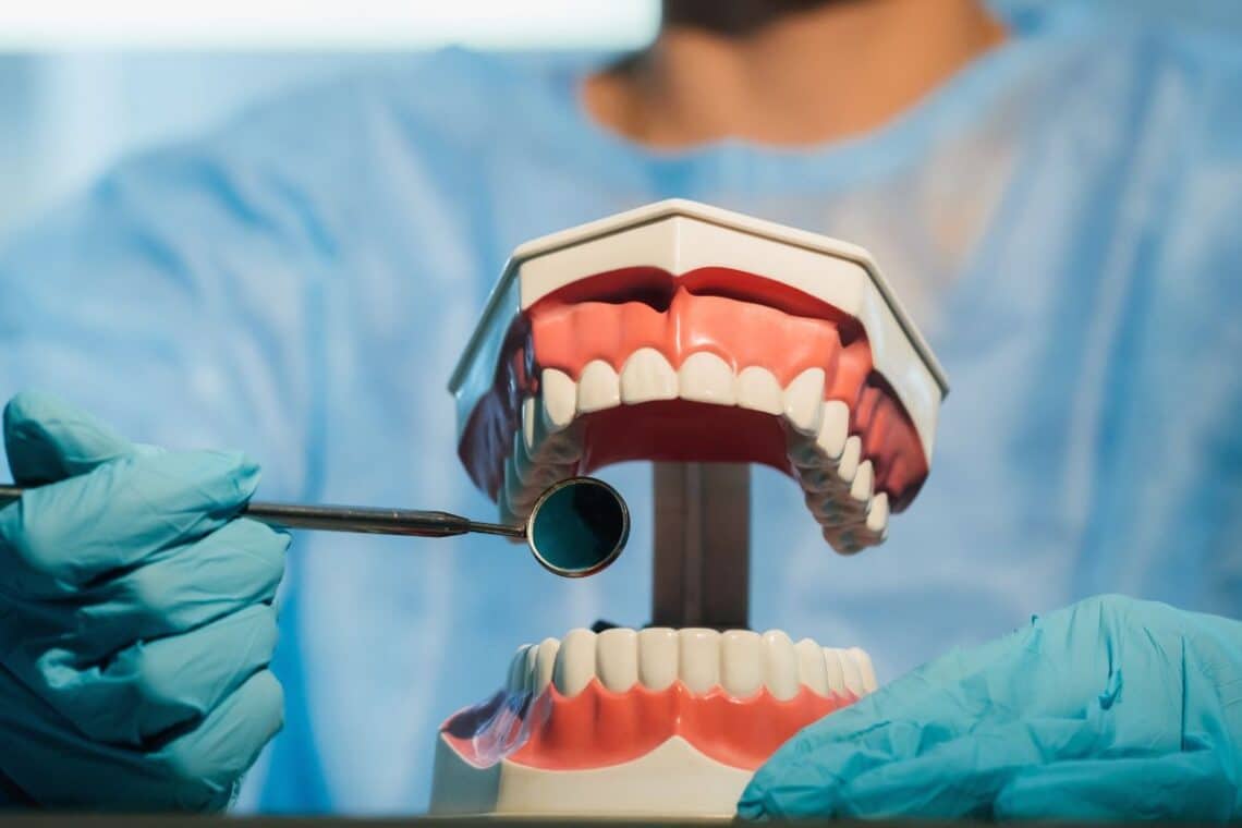 upper-dental-implants-sulphur-springs-dentist-tx