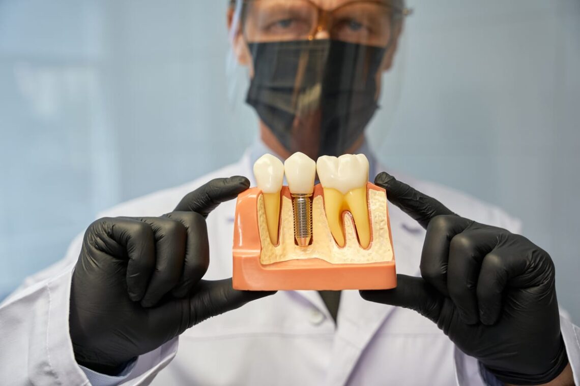 Dental Implants in Sulphur Springs
